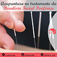 Instagram: Acupuntura no tratamento de paralisia facial.